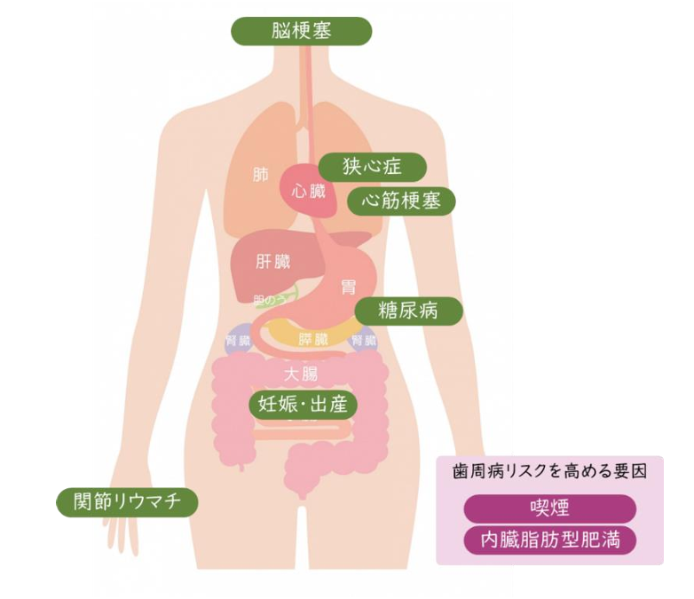 歯周病と全身疾患及び妊娠、生活習慣との関係性