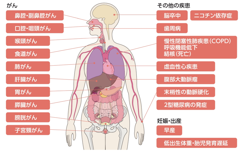 たばこを吸っているとなりやすい病気